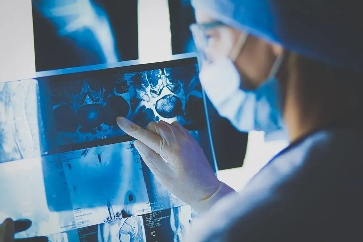 Rodzaje nowotwor&oacute;w leczonych chirurgicznie