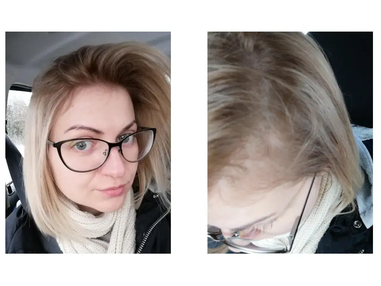kobieta z delikatnym odrostem blond