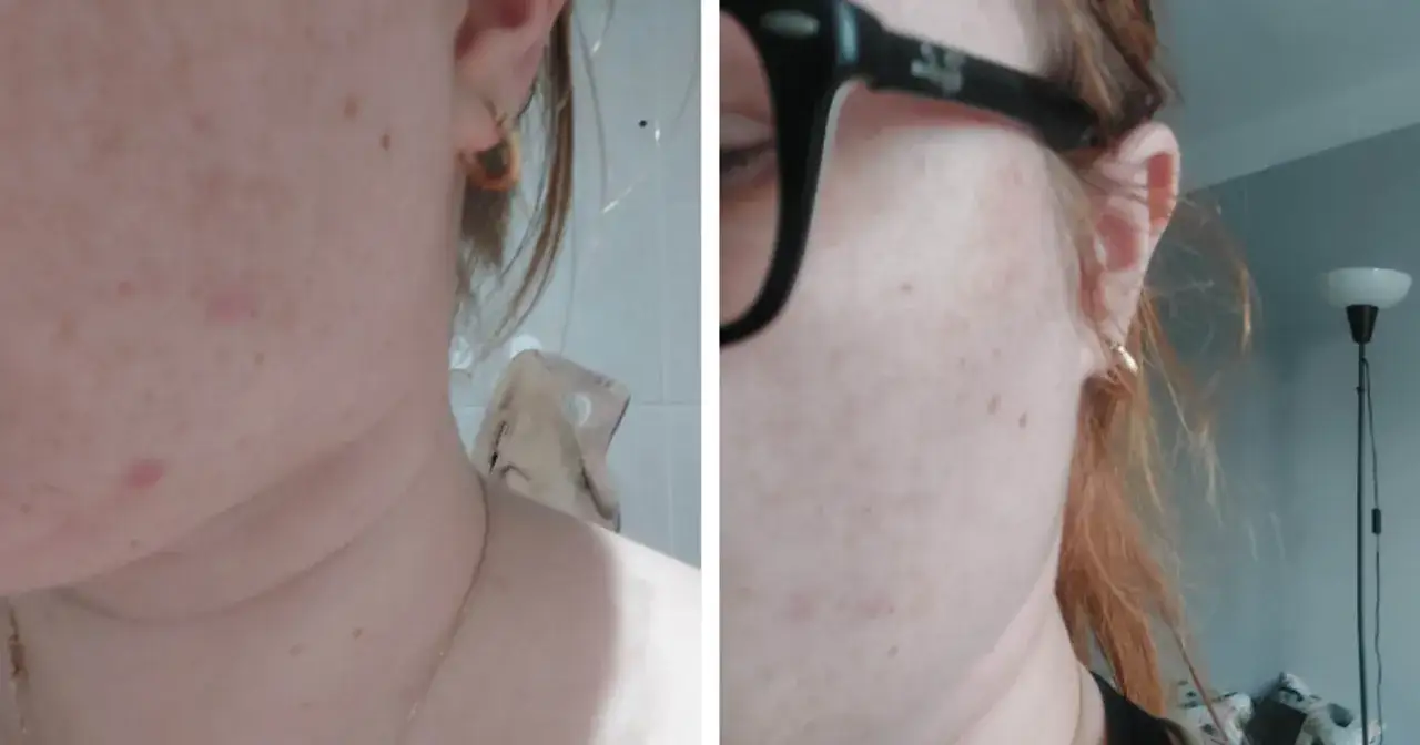 Efekty stosowania serum do twarzy przed i po