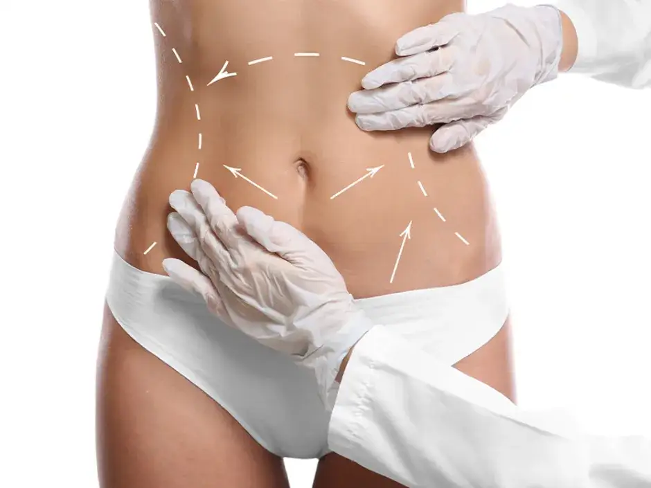 pacjent po liposukcji odzież uciskowa