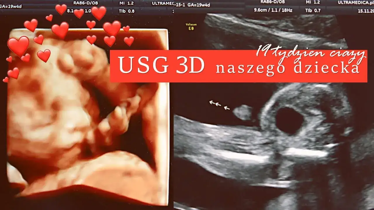 Zdjęcie Ile waży dziecko w 19 tyg ciąży? Waga, rozwój i USG połówkowe