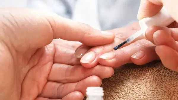 Zdjęcie Jak skutecznie przestać obgryzać paznokcie i odzyskać zdrowe dłonie