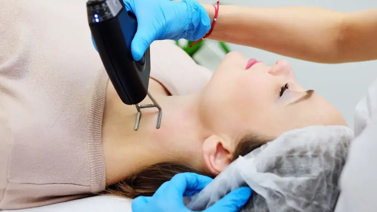 Zdjęcie Ile kosztuje zabieg laserem frakcyjnym CO2? Ceny i czynniki wpływające