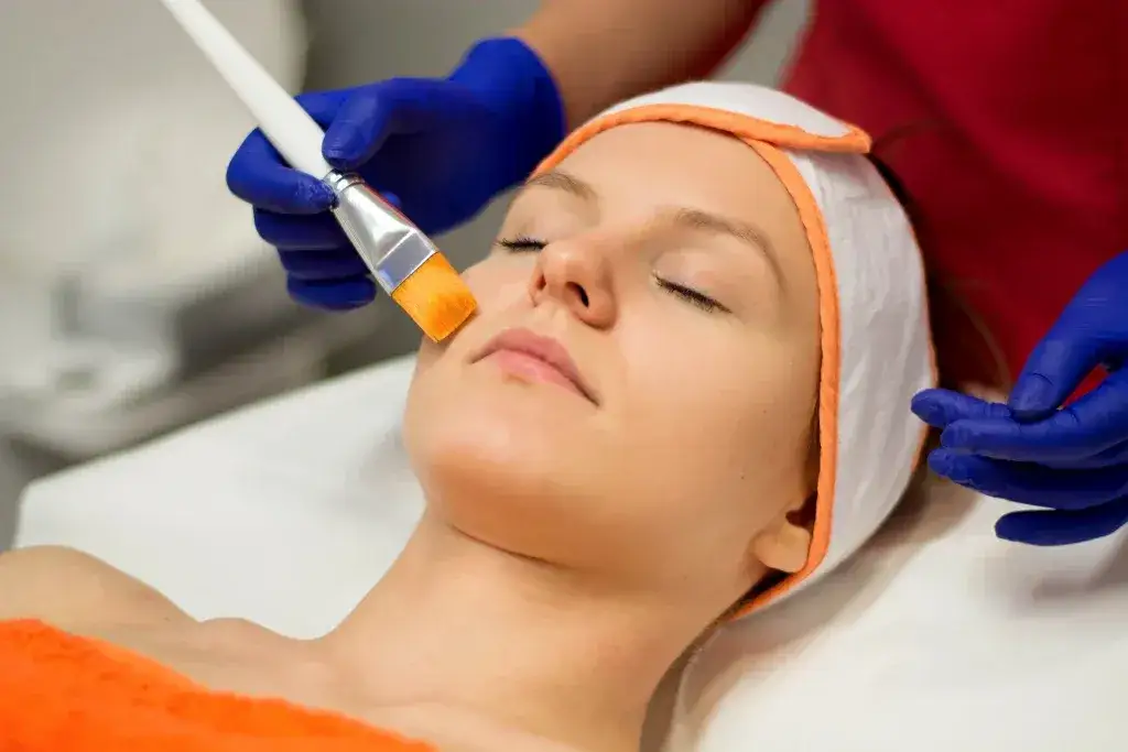 peelingi chemiczne mikrodermabrazja laseroterapia na trądzik