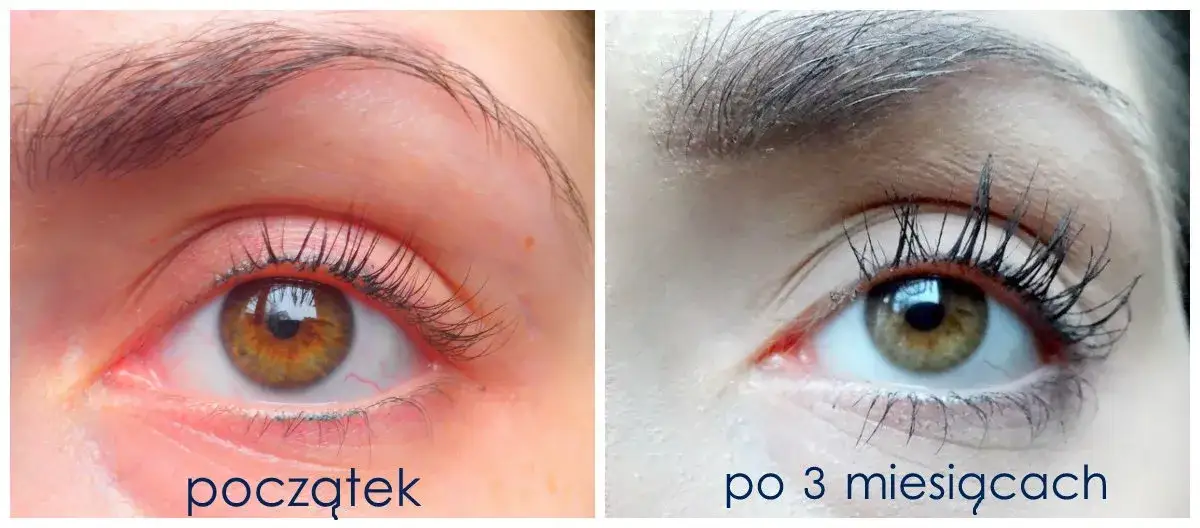 Zdjęcie Jak prawidłowo stosować Long 4 Lashes serum do rzęs? Efekty i błędy aplikacji