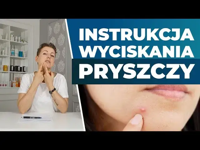 Zdjęcie Czy powinno się wyciskać pryszcze? Oto ryzyka i lepsze metody pielęgnacji