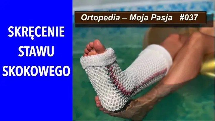 Zdjęcie Jak długo trwa rehabilitacja po operacji stawu skokowego? Sprawdź, co wpływa na czas powrotu do zdrowia