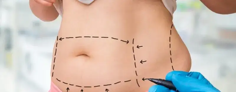 rekonwalescencja po liposukcji ubranko uciskowe