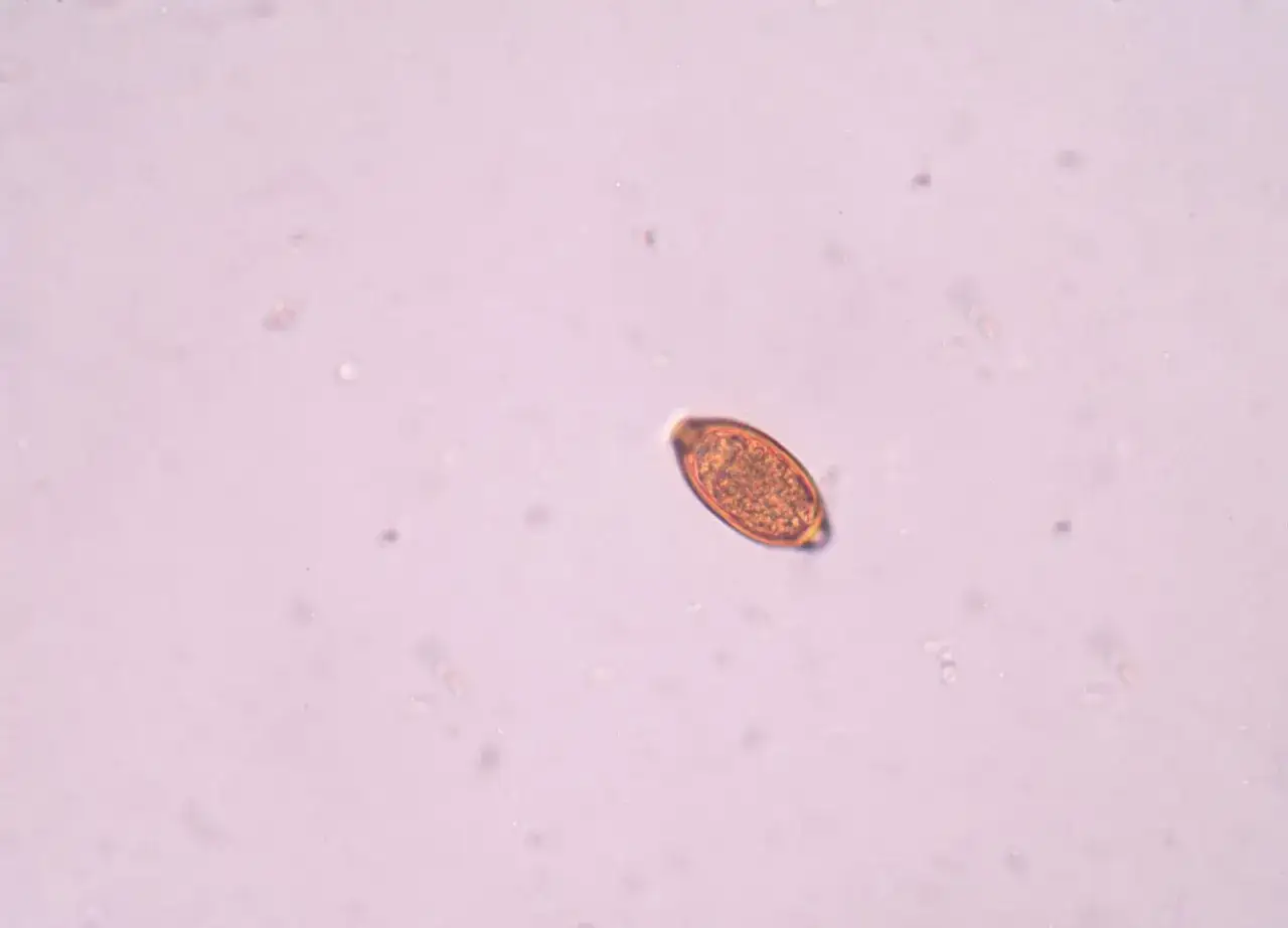 Jajo pasożyta pod mikroskopem, dow&oacute;d na obecność robak&oacute;w w kale.