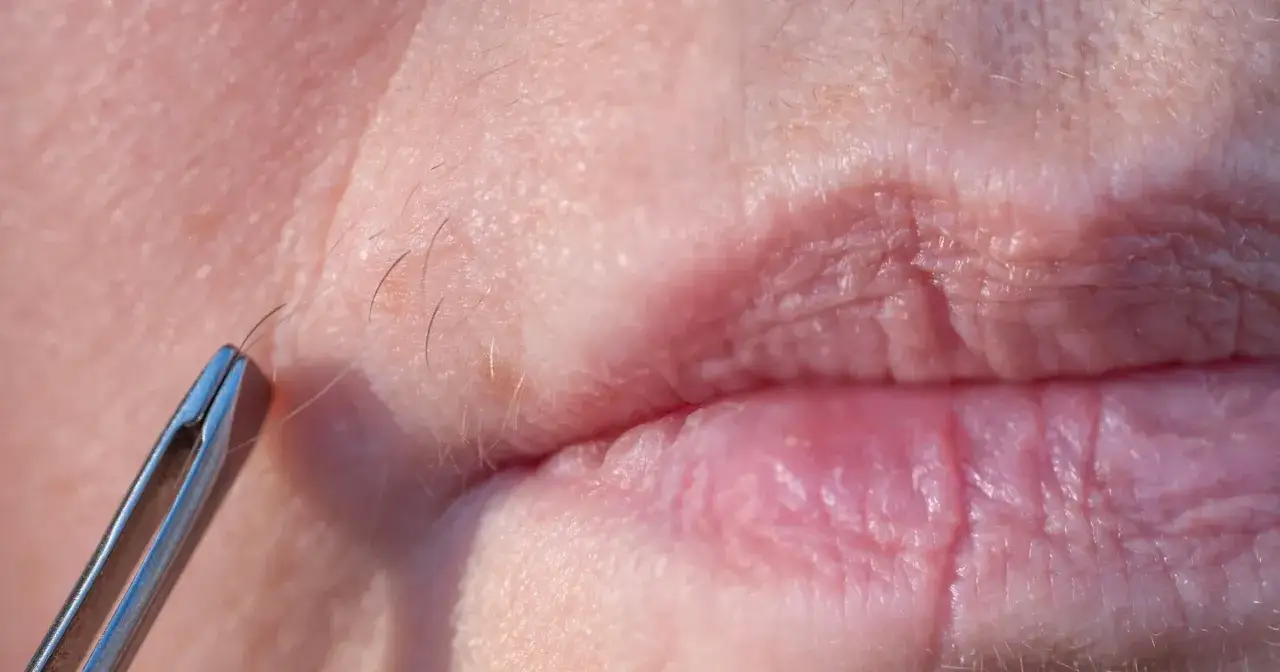 Pielęgnacja sk&oacute;ry po depilacji wąsika