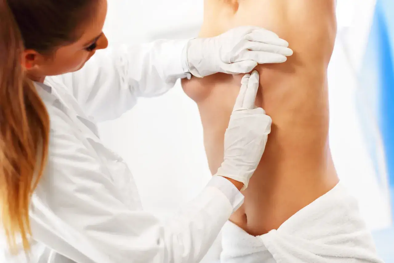 Lekarka bada twardą pierś po radioterapii.