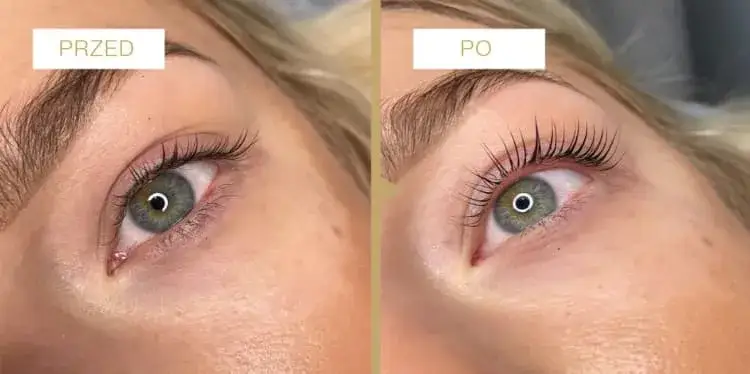 Zdjęcie Jak długo trzymają się rzęsy 1 1? Poznaj czynniki wpływające na trwałość