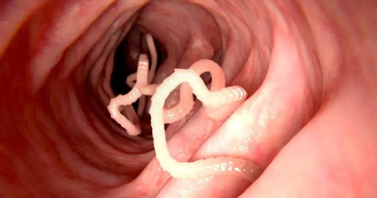 Zdjęcie Robaki w kale dziecka: Kiedy się martwić oraz jak szybko działać?