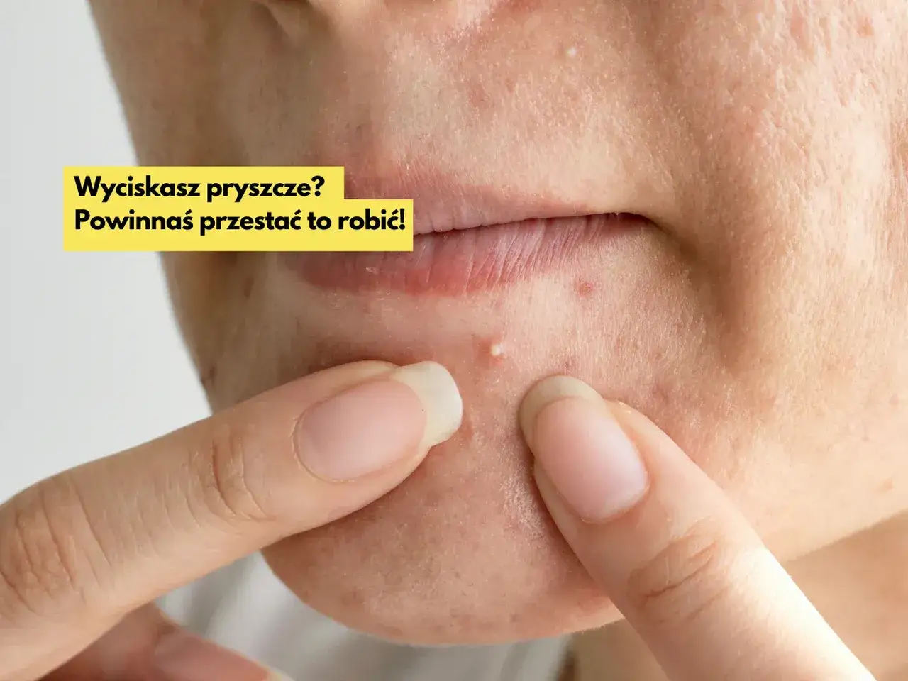 Dłonie zbliżają się do twarzy z pryszczem. Tekst: 