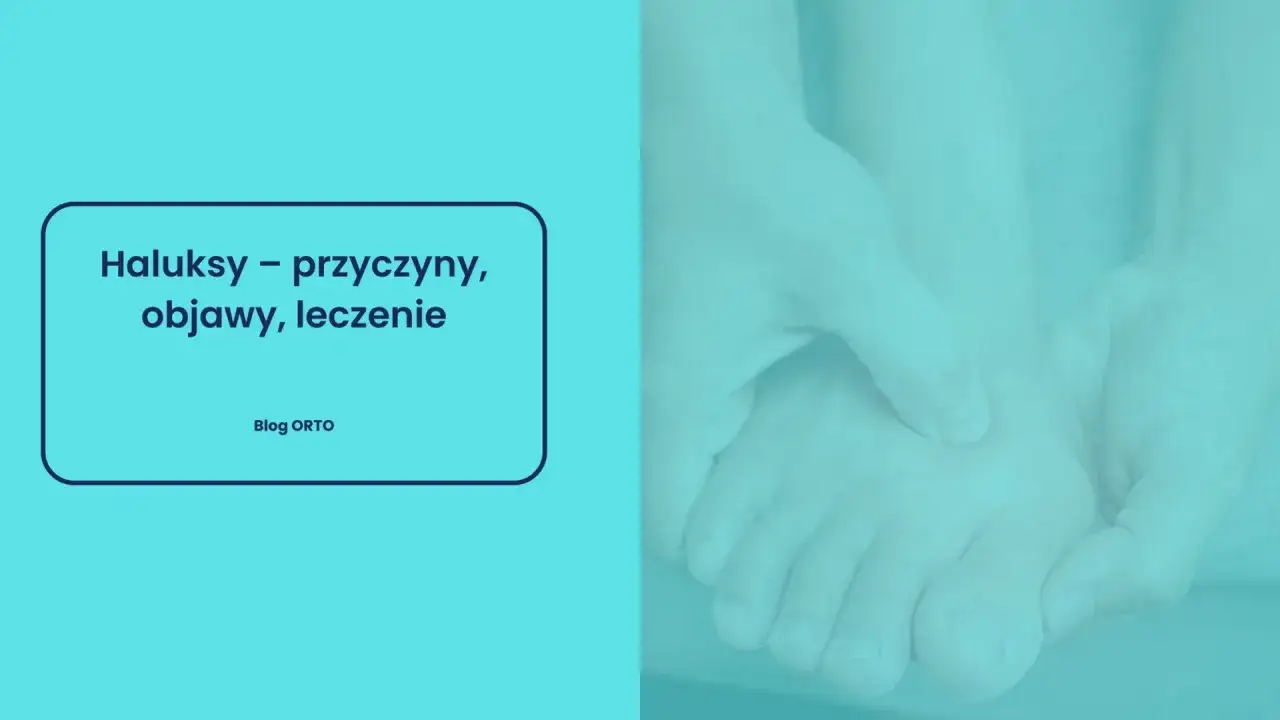 Zbliżenie na stopę, pokazujące jak wyglądają haluksy na stopach. Tekst: 
