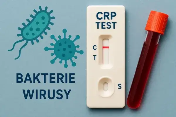 Wykres poziom&oacute;w CRP a rodzaje infekcji (wirusowe, bakteryjne)