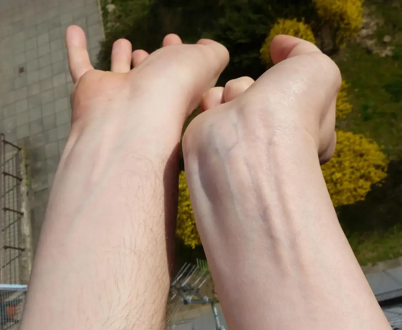 test żył nadgarstek tonacja sk&oacute;ry