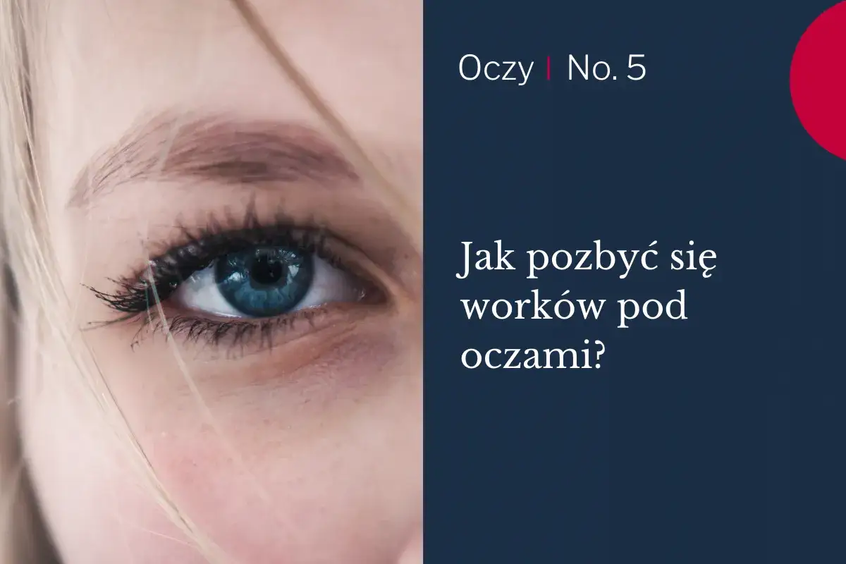 Zdrowy styl życia a worki pod oczami