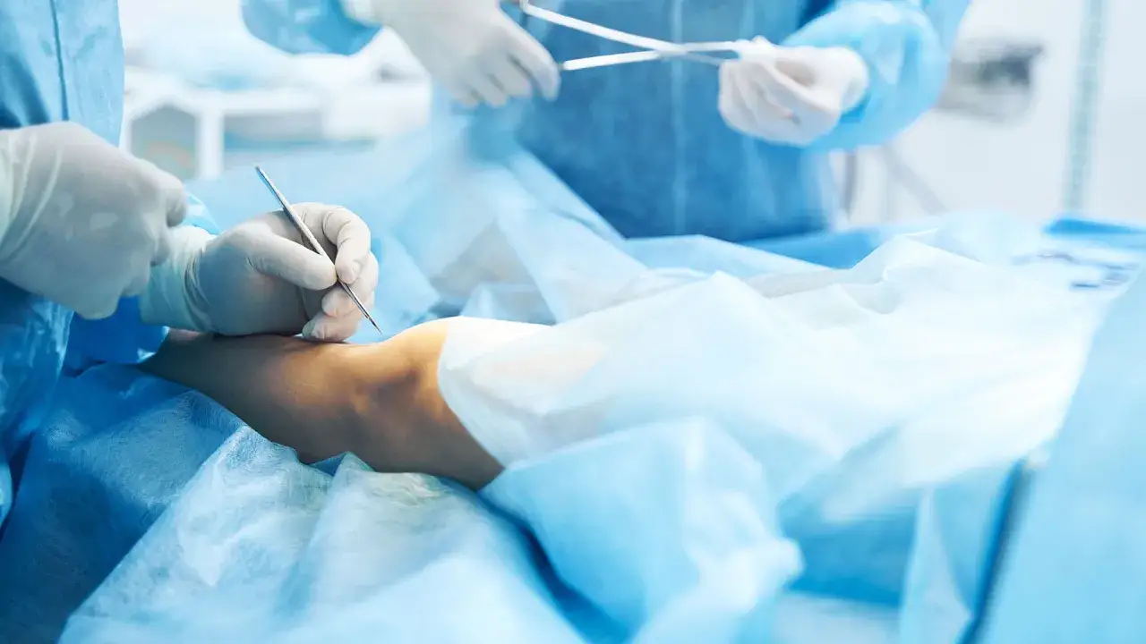 Najczęstsze choroby leczone przez chirurga og&oacute;lnego