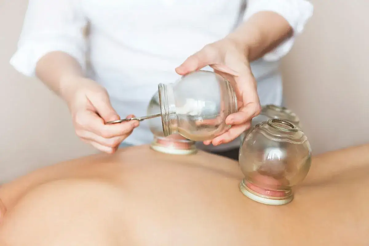 Terapeuta stawia bańki na plecach pacjenta. To tradycyjna metoda leczenia, która pomaga w łagodzeniu bólu i poprawie krążenia.