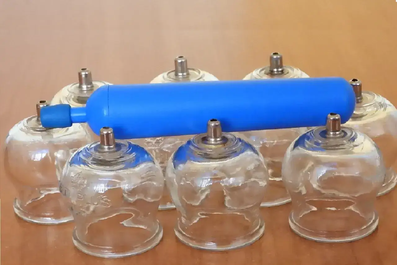 Zestaw szklanych baniek na przeziębienie z niebieską pompką.