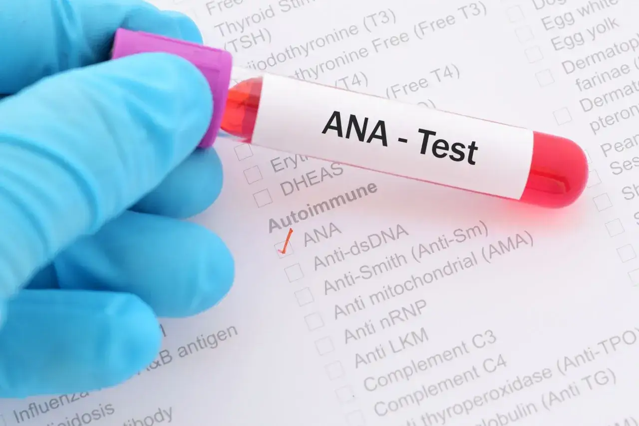 Grafika por&oacute;wnująca c-ANCA i p-ANCA