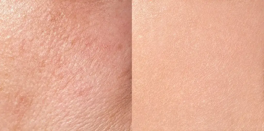 cera sucha vs odwodniona