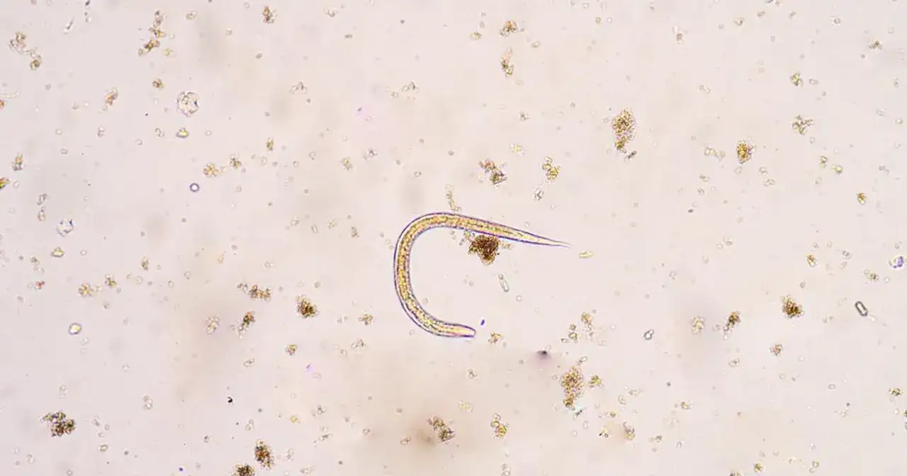 Mikroskopowy obraz robak&oacute;w w kale. Widać jednego pasożyta w kształcie nitki, otoczonego drobnymi cząstkami.