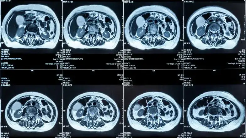 porównanie tomografia rezonans usg trzustki