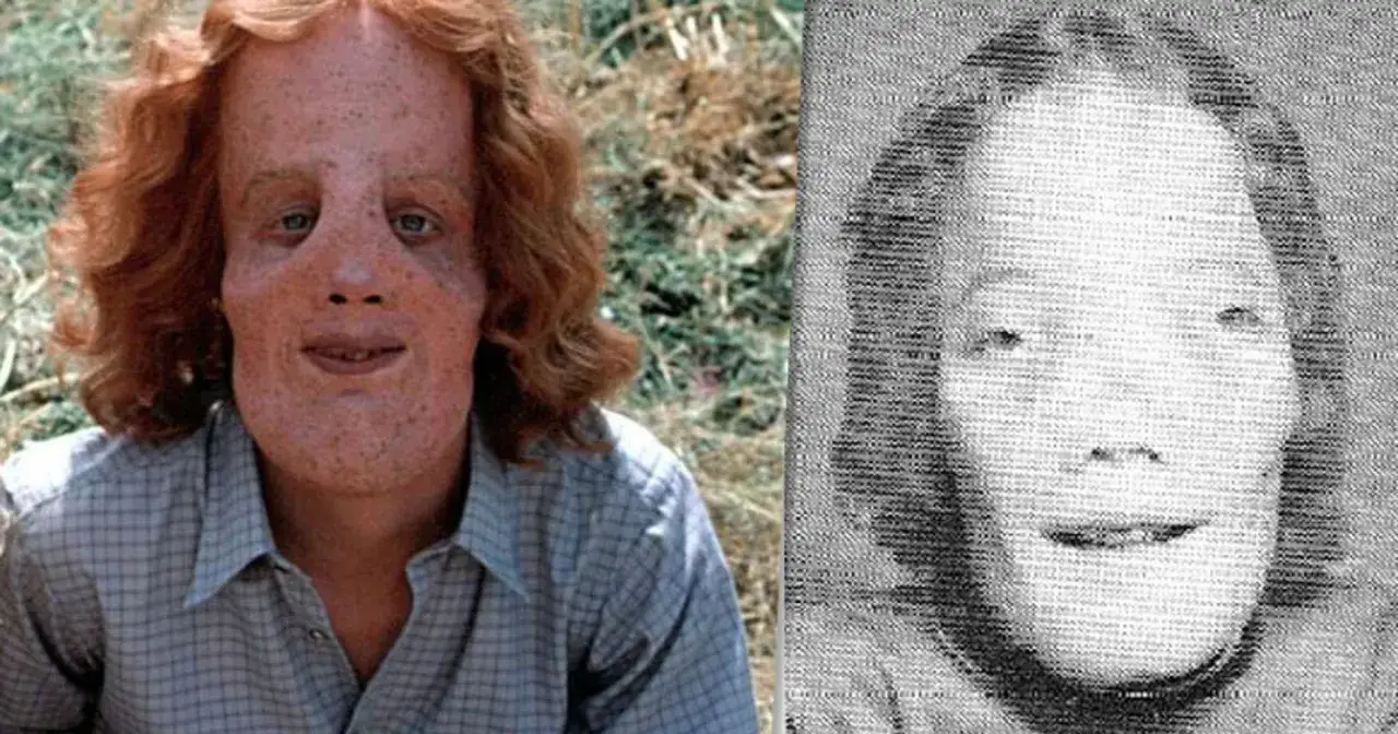 Roy L. Rocky Dennis prawdziwa historia