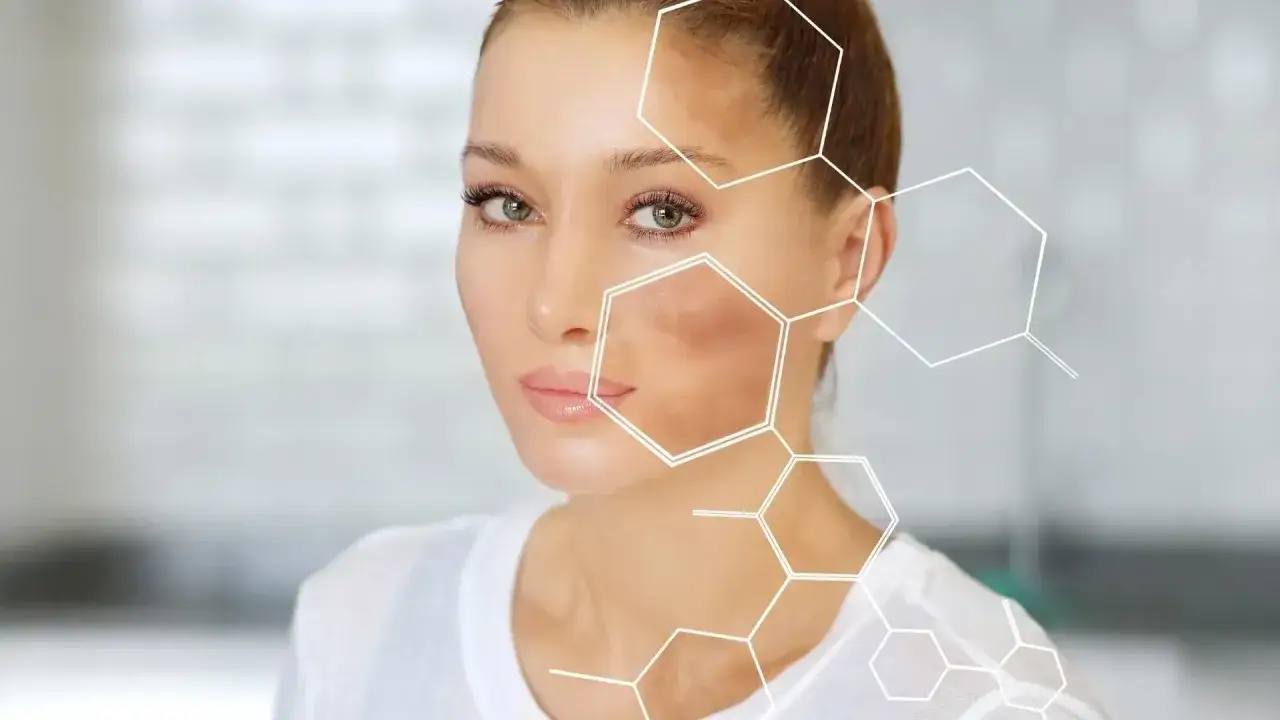 Kobieta z przebarwieniami na twarzy, szukająca rozwiązania co na przebarwienia na twarzy. Grafika przedstawia strukturę chemiczną.
