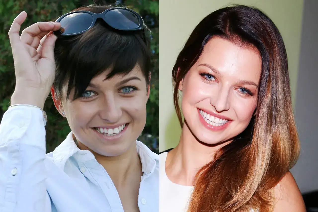 Anna Lewandowska kiedyś i dziś. Dwa ujęcia tej samej kobiety, porównanie jej wyglądu na przestrzeni lat.