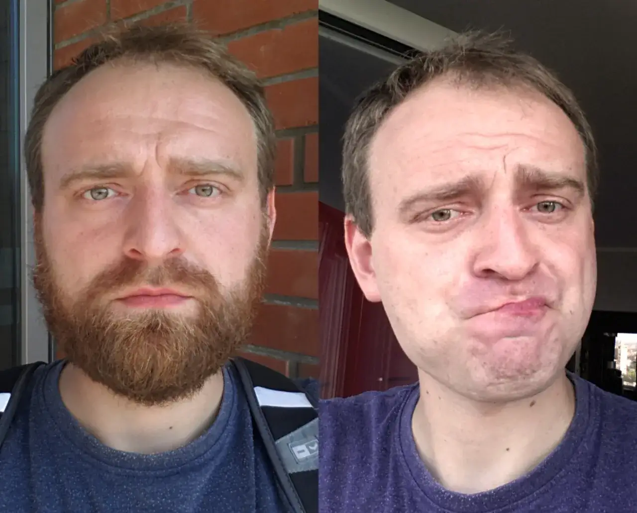 Zdjęcie Czy golenie brody przyspiesza porost? Odkryj prawdę o mitach