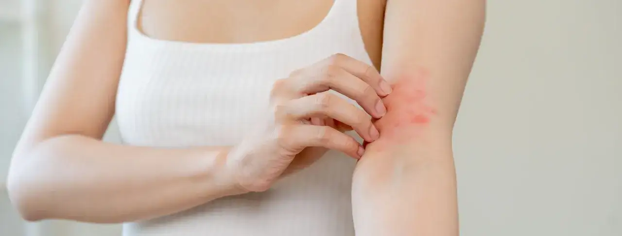 Zdjęcie Alergia na leki objawy – jak rozpoznać groźne reakcje alergiczne