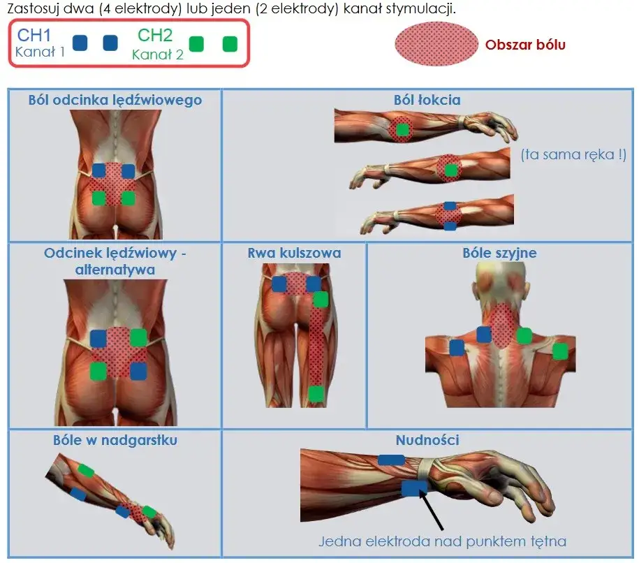 Schemat działania TENS konwencjonalnego i akupunkturowego