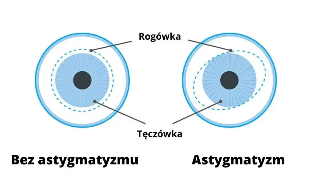 astygmatyzm okulary soczewki porównanie
