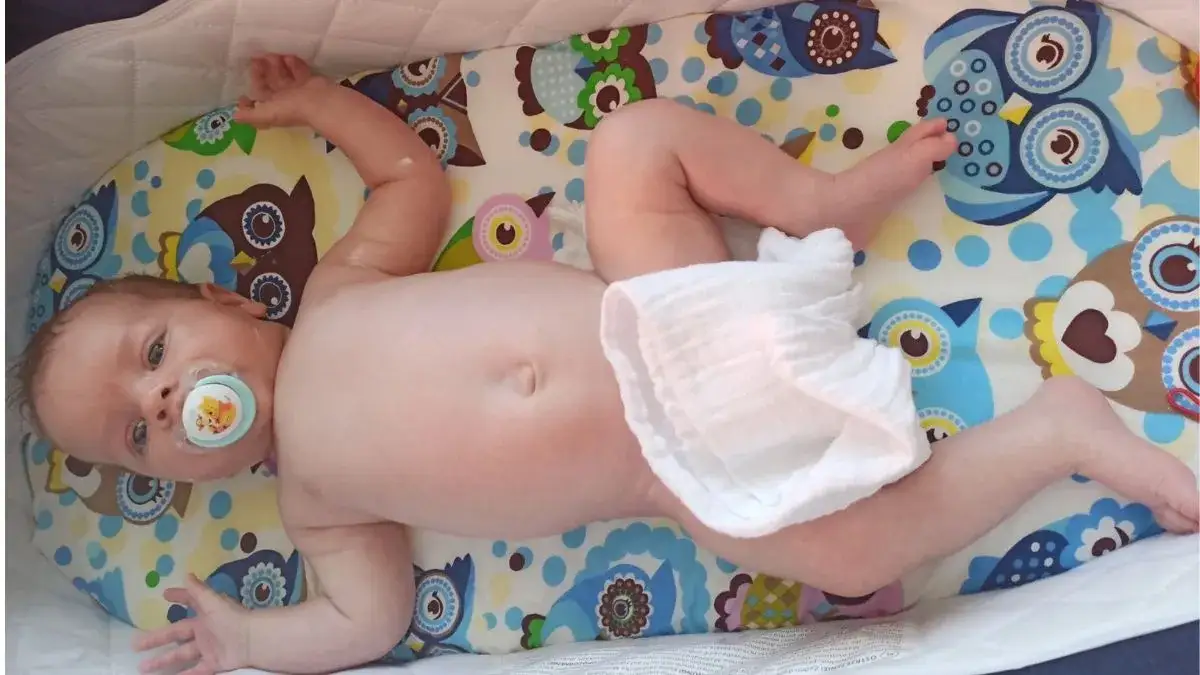 Zdjęcie Jak wyglądają odparzenia u niemowlaka? 7 oznak do rozpoznania