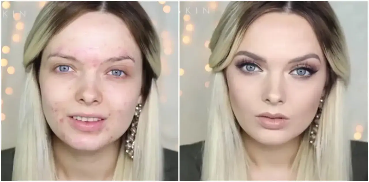 Zdjęcie Jak dobrze zakryć pryszcza i uniknąć widocznych niedoskonałości