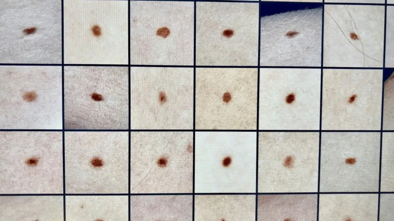 Dermatolog wykonujący badanie dermatoskopowe