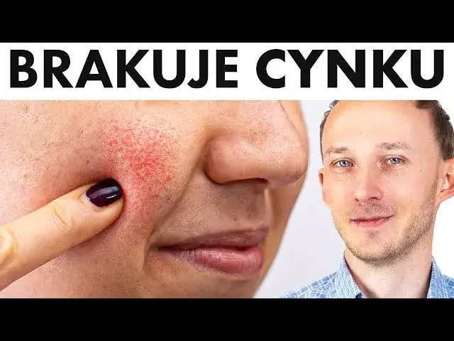 wczesne objawy niedoboru cynku grafika