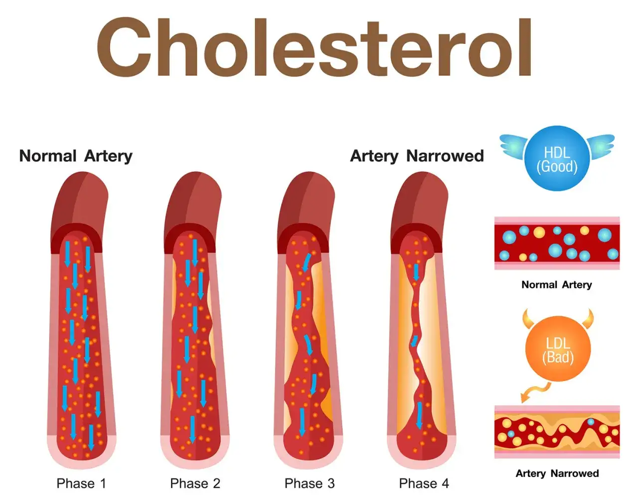 cholesterol HDL LDL por&oacute;wnanie