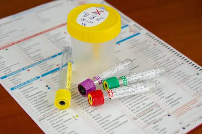 Wyniki badania kwasu moczowego normy