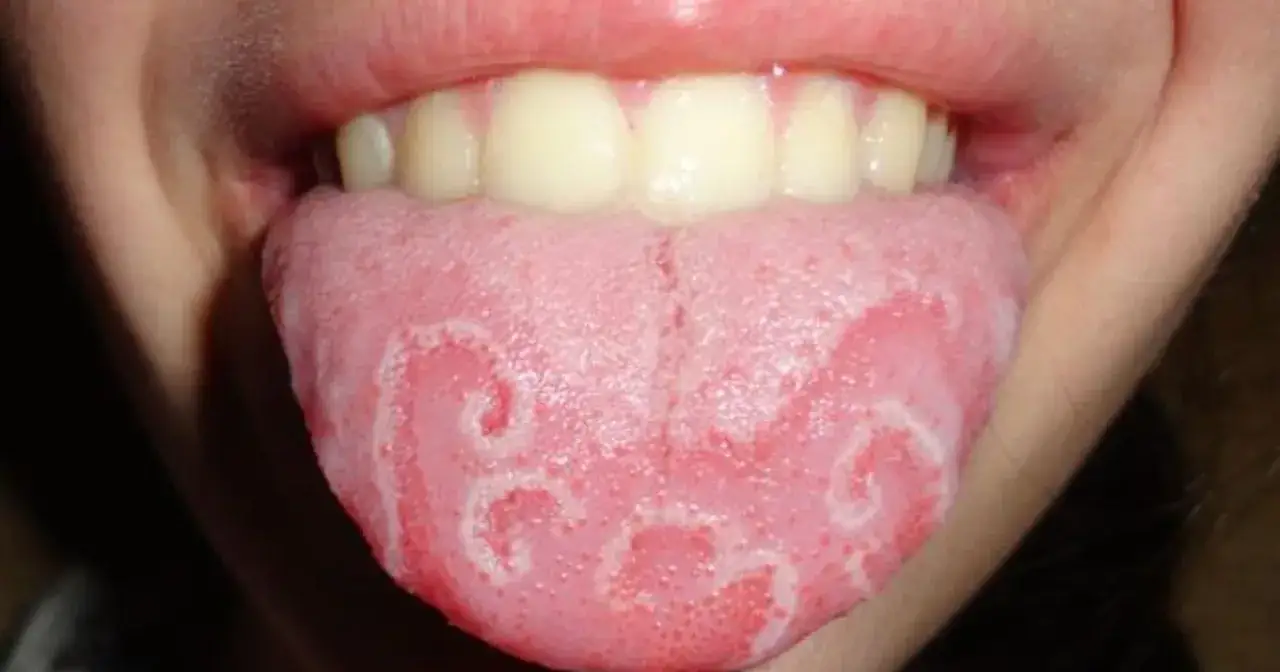 Język geograficzny z białymi, nieregularnymi plamami przypominającymi mapę.