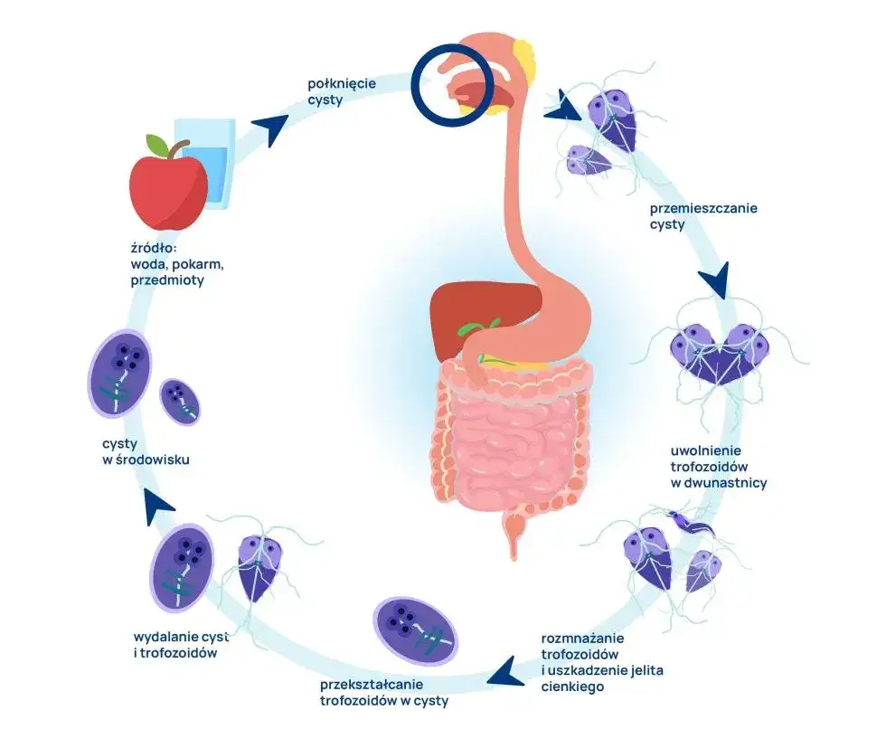 objawy lambliozy u dorosłych i dzieci
