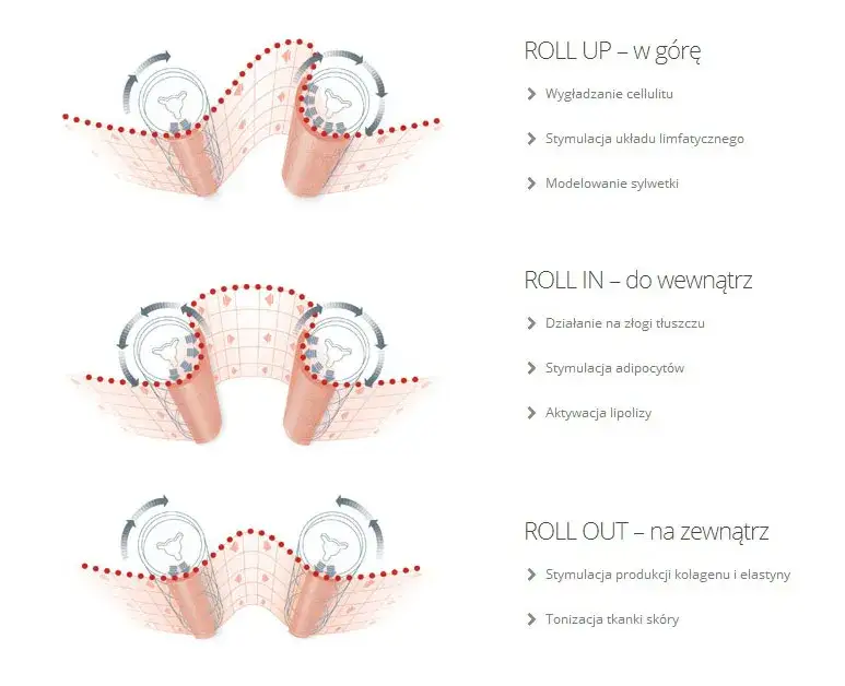 endermologia jak działa głowica