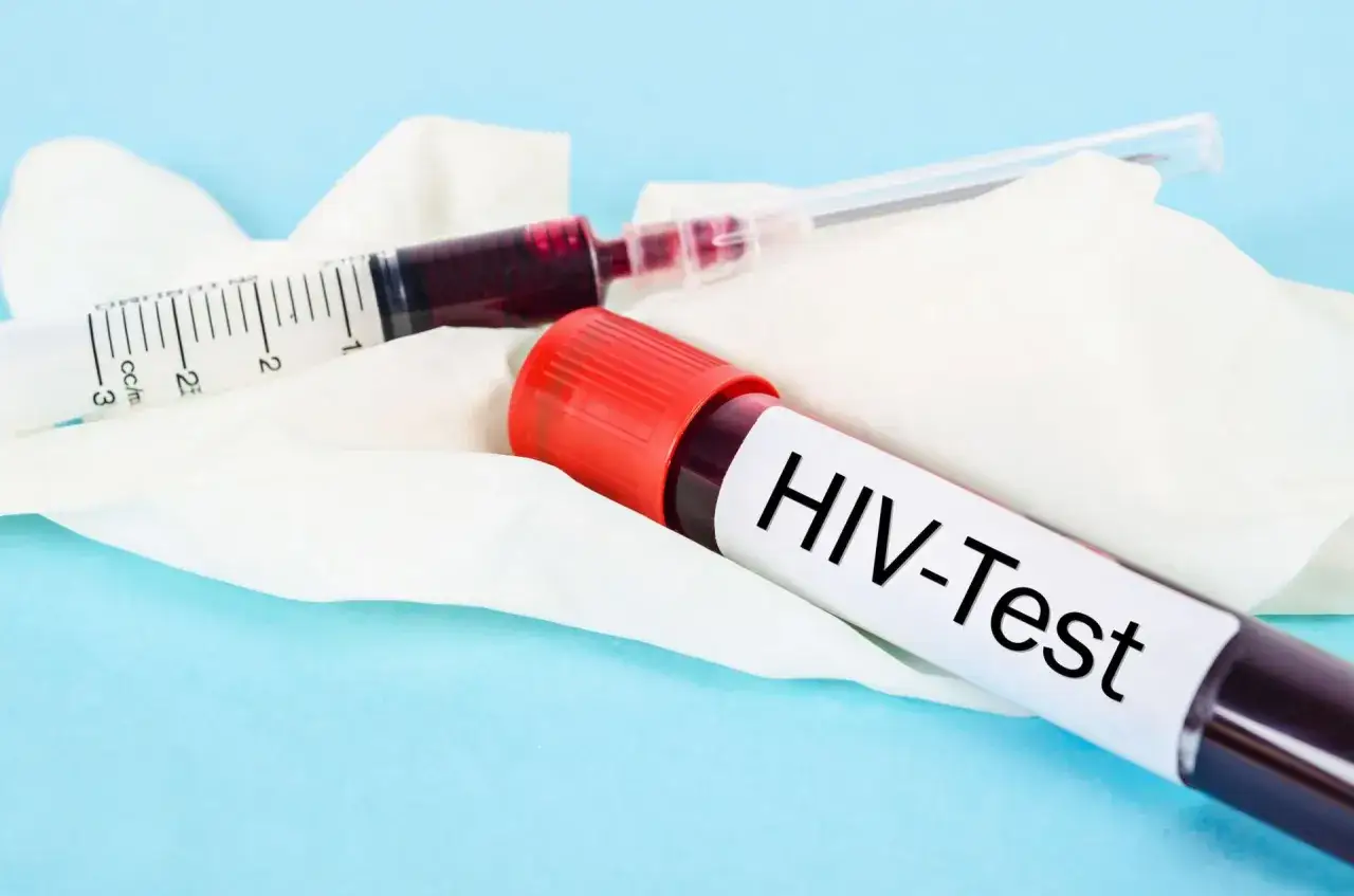 Próbka krwi do badania HIV-Test. Zastanawiasz się, ile kosztuje test na HIV w laboratorium?