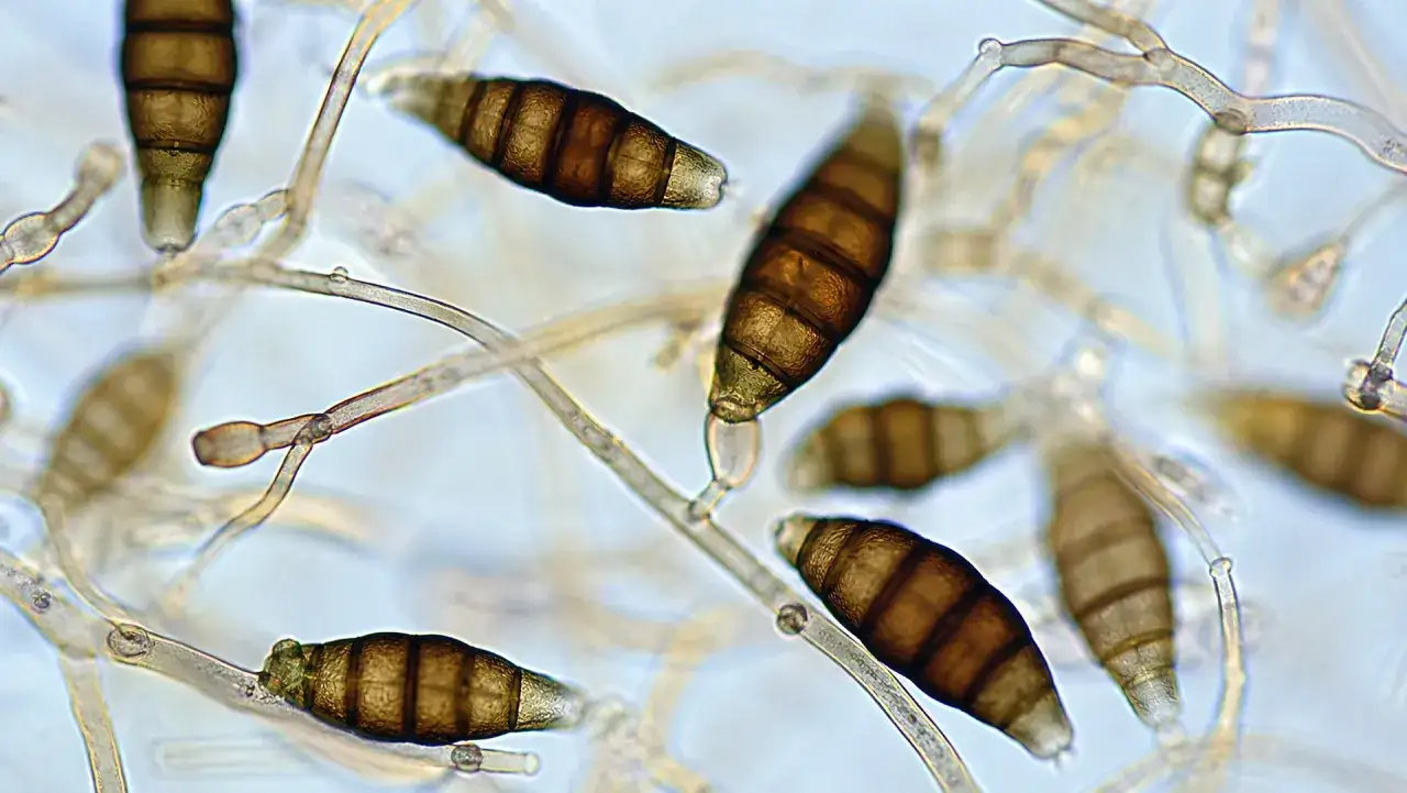 Mikroskopijny obraz grzybni i zarodnik&oacute;w grzyba Alternaria alternata. Zarodniki są brązowe, wielokom&oacute;rkowe, o charakterystycznym kształcie.