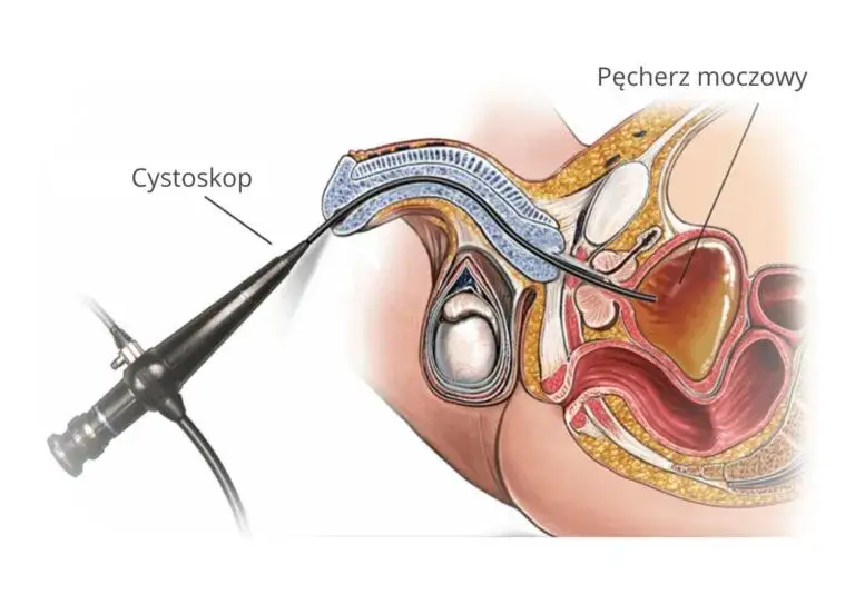 USG urologiczne, cystoskopia, biopsja prostaty