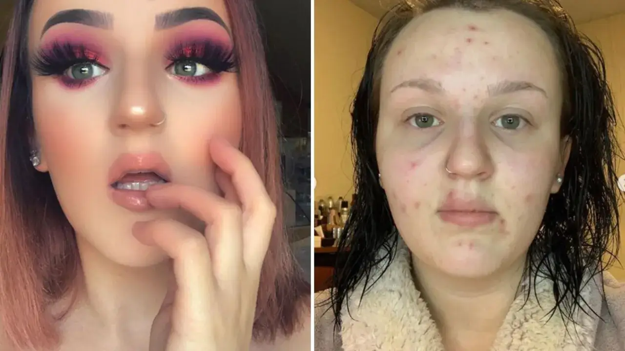 Nie wyciskaj pryszczy ostrzeżenie