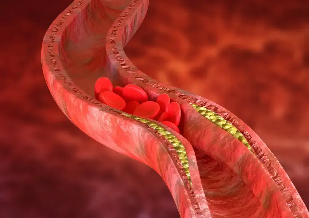Zdjęcie Podwyższony poziom cholesterolu HDL - czy naprawdę musisz się martwić?